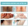Black Acanthoderma Moisturizing Repair Cream Brightening Armpits Arms Knees Lightening Emulsion Brighten Skin Body Care Cream 3