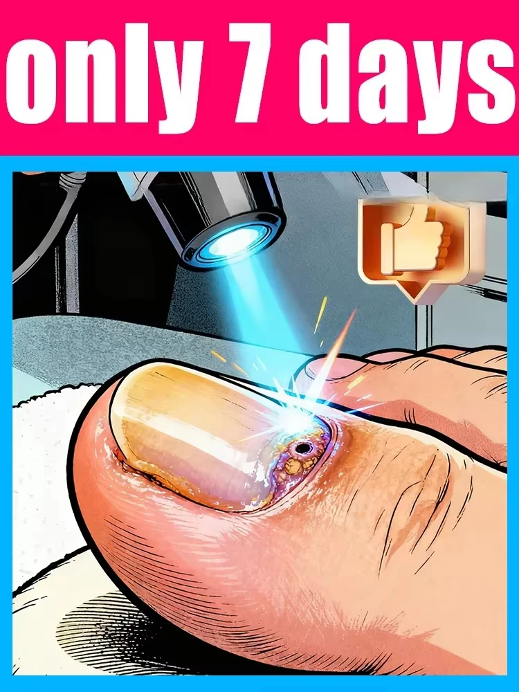 5세대 샴페인 컬러 네일 레이저 펜은 당신에게 좋은 브이데스를 빌어드립니다. ..