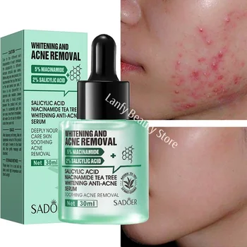 Acne Removal Whitening Serum Effective Fade Acne Spots Repair Product Control Moisturizing Shrink Pores Acne Treatment Skin Care