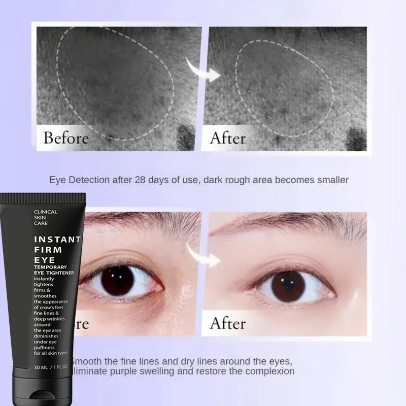Wrinkle Eye Care Eye Bags Removal Eyes Cream Lifting Firming Temporary Bag Removal Dark Circles