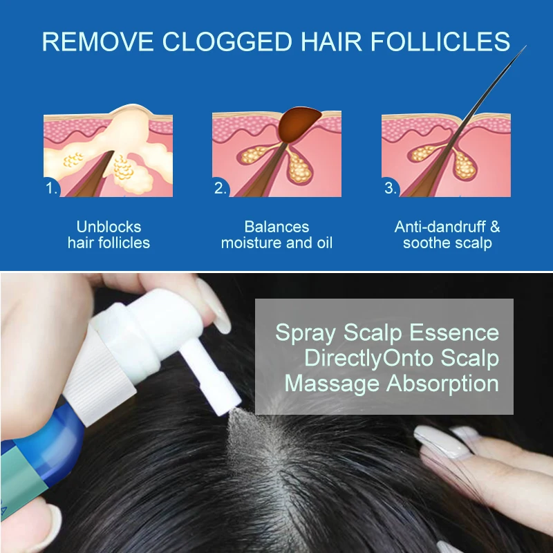 Hair Scalp Treatment Hair Oil Dandruff Itching Anti Loss Oil Control Smoothing Essence Spray Care Beauty Health 60ML PURC