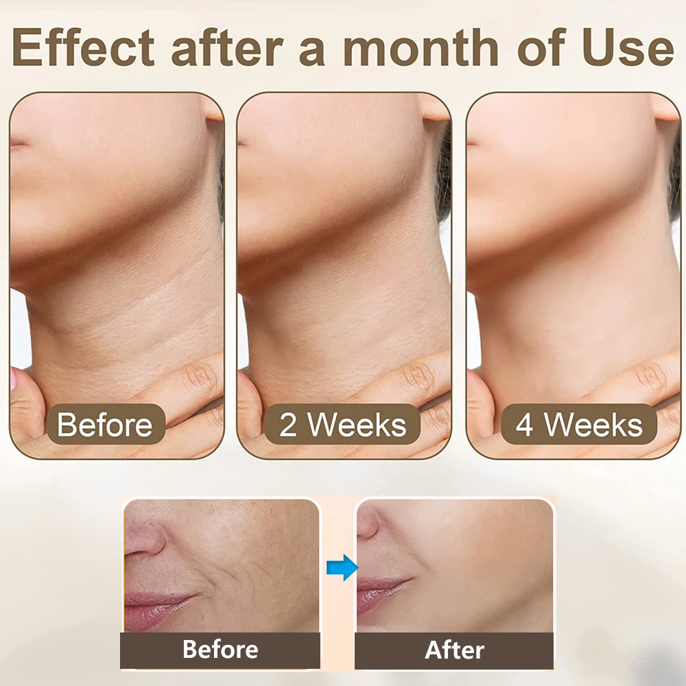 Electric Neck Facial Eye Massager V-line Face Lifting Anti Aging Wrinkle Removal Double Chin Remover neck face massager face lifting roller electrotherapy skin care tool