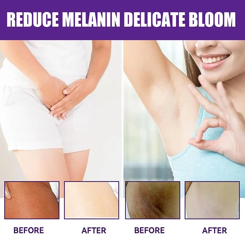 Whitening Cream Private Parts Underarm Bleaching Whiten Butt Knee Brighten Inner Thigh Intimate Parts Dark Remove Melanin Care 3