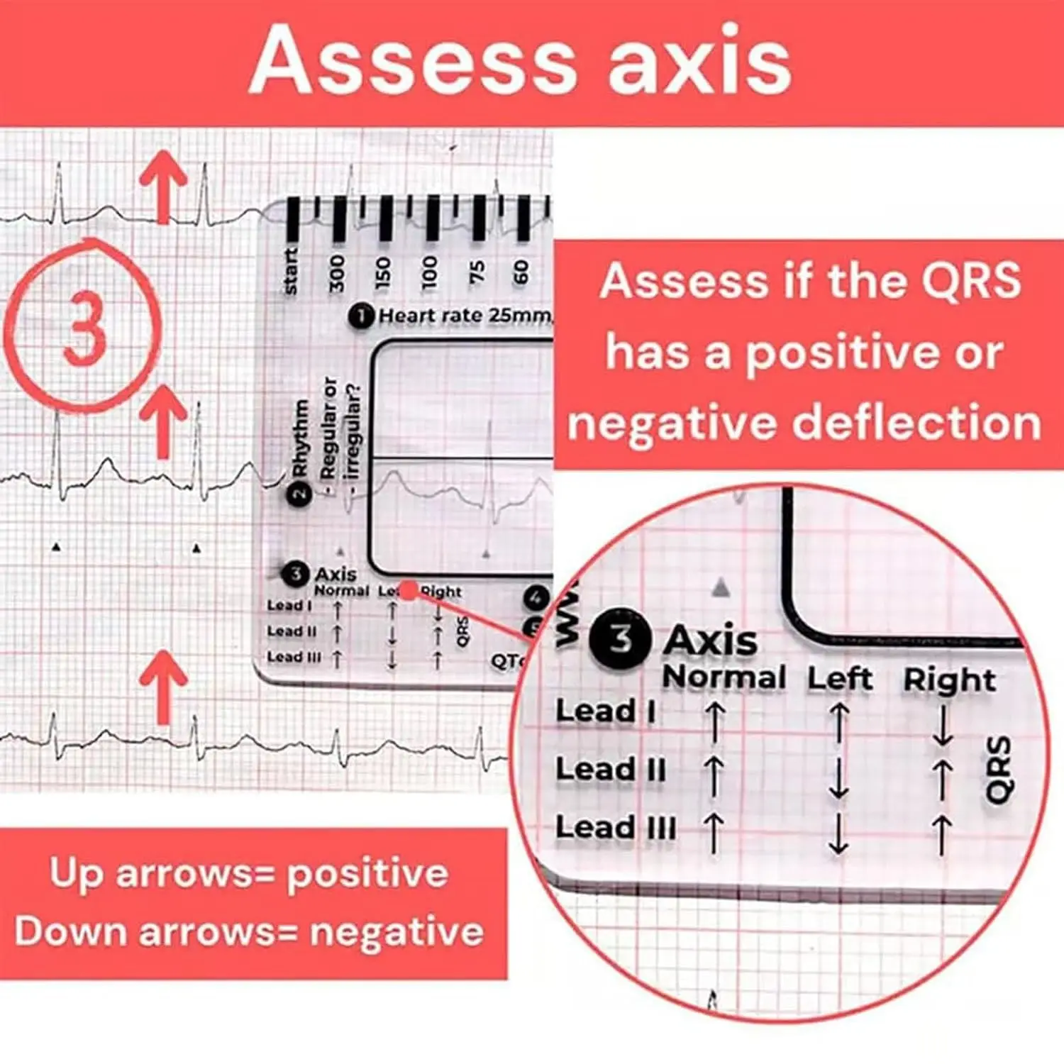 7 Step Ecg Ruler Plastic Ruler Card for Ecg/ekg Interpretation Portable Pocket Ecg Ekg Guide With Sheath Emergency Tool