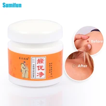 

1Pc 15g Wart Removal Ointment Warts Treatment Repair Cream Foot Care Skin Tag Remover Plantar Moisturize Antibacterial Ointment