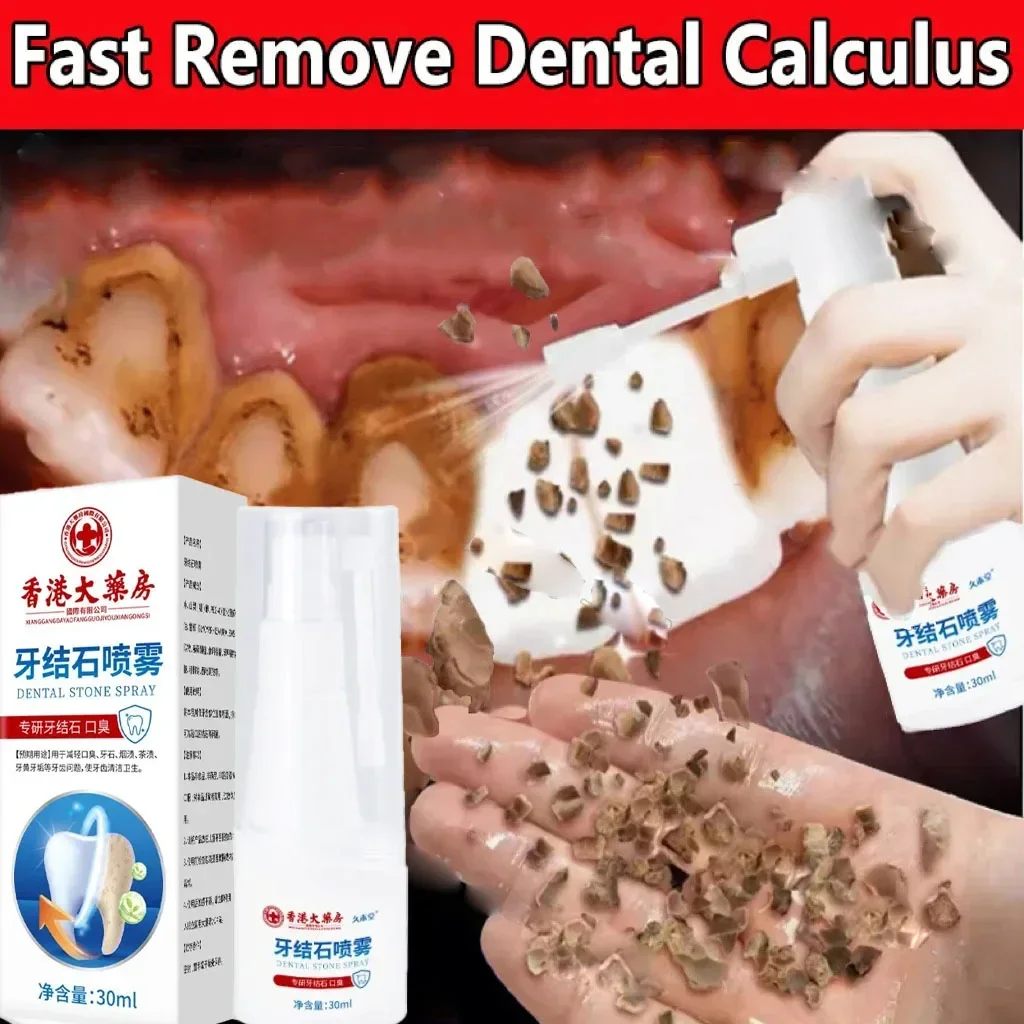 Dental Calculus Remover Teeth Whitening Spray Toothpaste Cleaning Oral Hygiene Removal Halitosis Plaque Stains Fresh Breath Care teeth whitening product,dental calculus remover,teeth health product