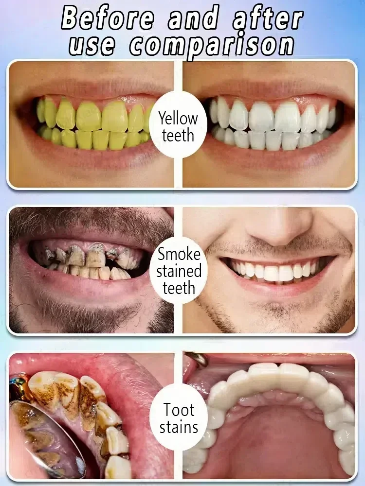 Teeth Whitening Deep Cleaning Cigarette Stains Repair Bright Neutralize Yellow Tones Dental Plaque Fresh Breath Teeth whitening product