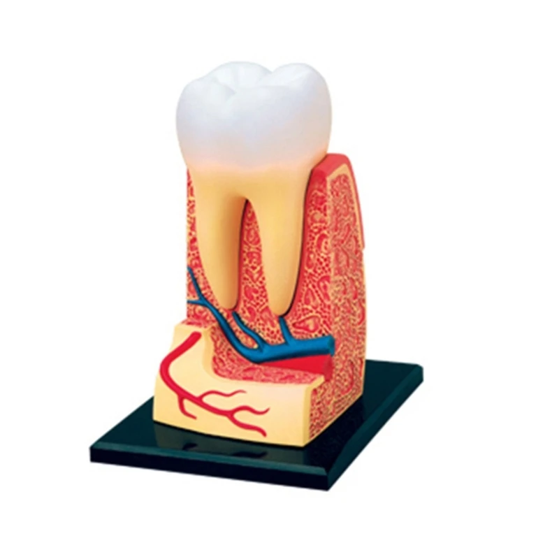 

G5AA Dental Demonstration Model Crown Bridge Demonstration Teeth Model Removable Demonstration Study Teaching Teeth Model