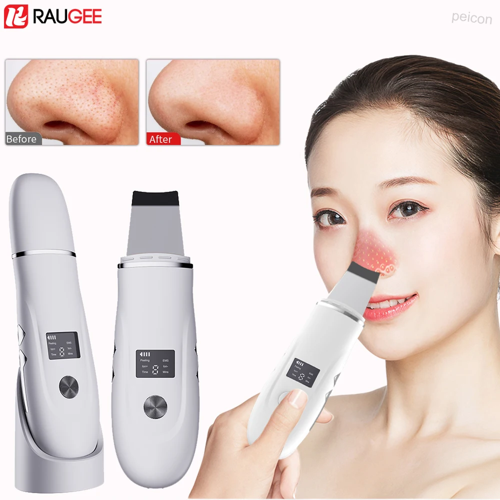 Ultrasonic Skin Scrubber Peeling Blackhead Remover Facial Spatula Deep Face Cleaning Pore Cleaner Facial Shovel Cleanser