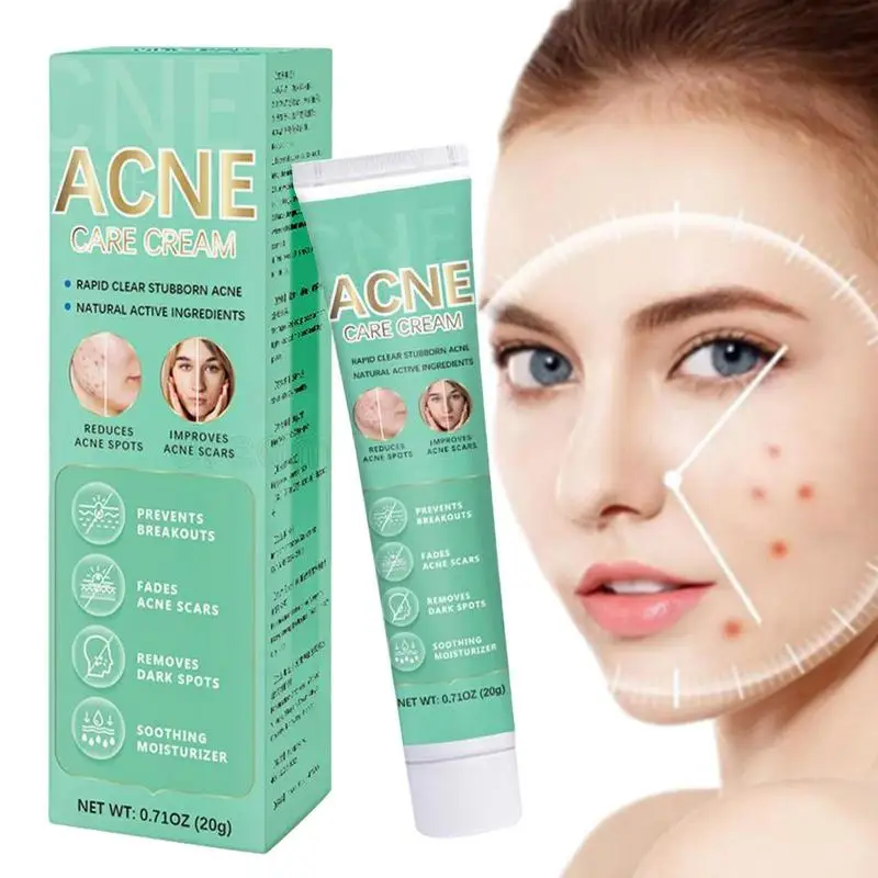 

Herbal Pimple Removal Cream Whitening Moisturizing Shrink Pores Oil Control Pimple Gel Skin Care Face Cream For Men Women