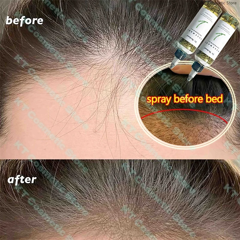 100ML Fast Hair Growth Oil Africa Crazy Traction Alopecia Serum Anti Hair Break Thicken Hair Loss Treatment Spray For Man Women 2