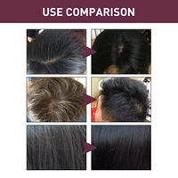 Polygonum Multiflorum Shampoo Soap Remove Dandruff Reduct Hair Loss Restore Natural Black Hair Strengthen Hair Roots Hair Care 2