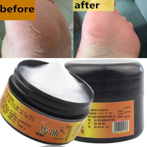 Oil  Foot Cream Dead Skin Remover Fast Repair Foot Cream Skin Care Moisturizing Anti-Drying Crack Strong Effective Cream