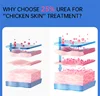 New Chicken Skin Repair Cream Curing Keratosis Follicle Pilaris Remove Thick Pores Body Dark Spot Moisturize Smooth Skin Care 5