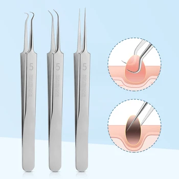 3pcs Acne Removal Tools 1