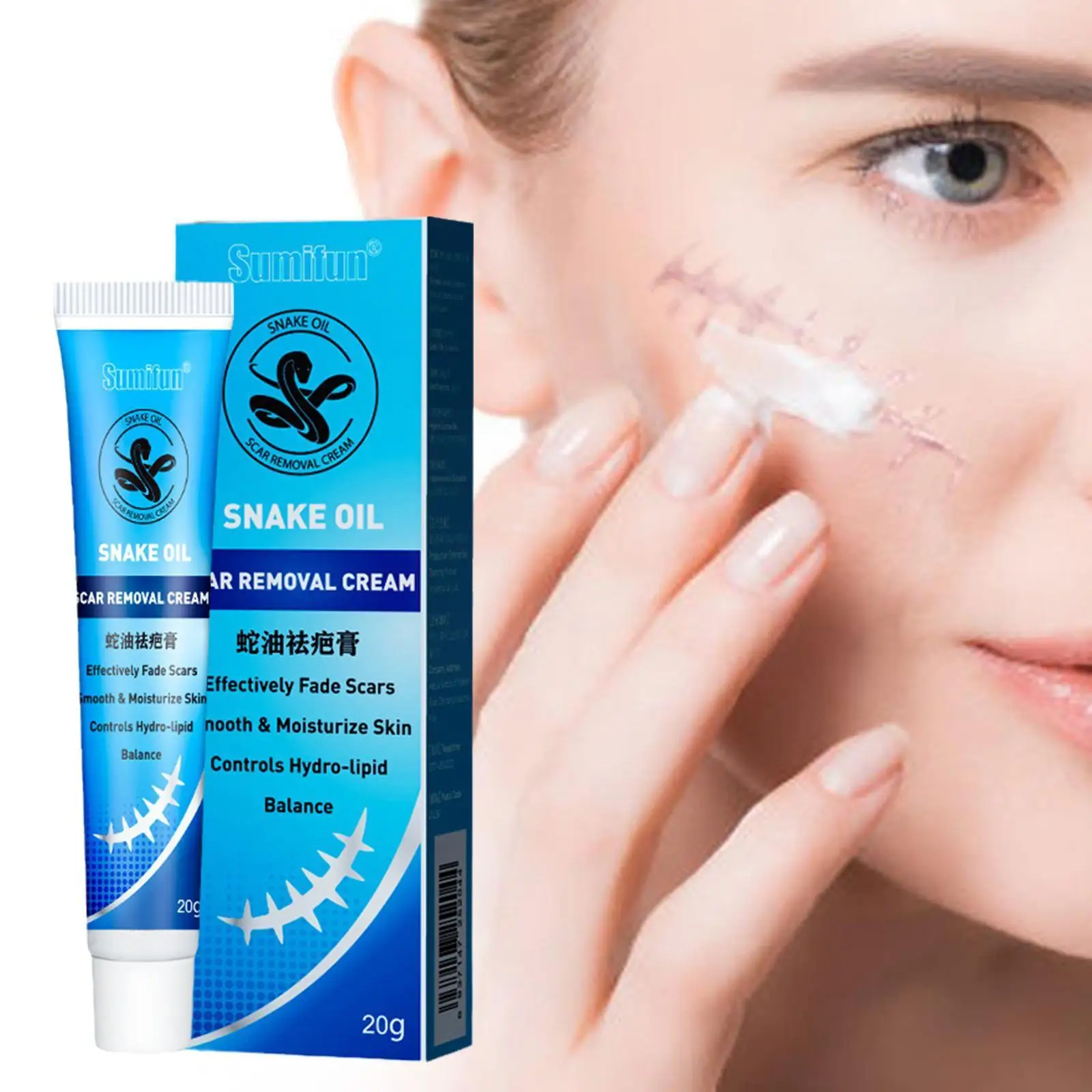 Herbal Scar Removal Cream Stretch Marks Treatment Pimples Repair Tones