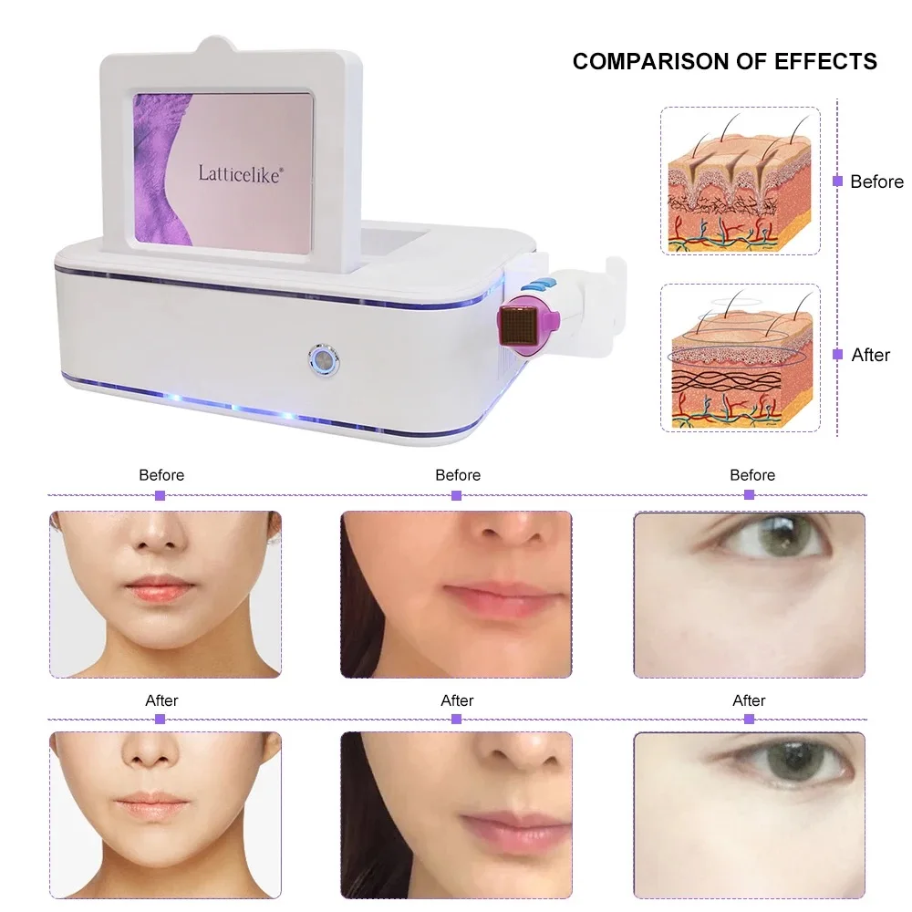 Newest Flx 5th Portable Therm Flx Fractional RF Machine Skin tightening Anti-aging Wrinkle Remover Beauty Machine 4