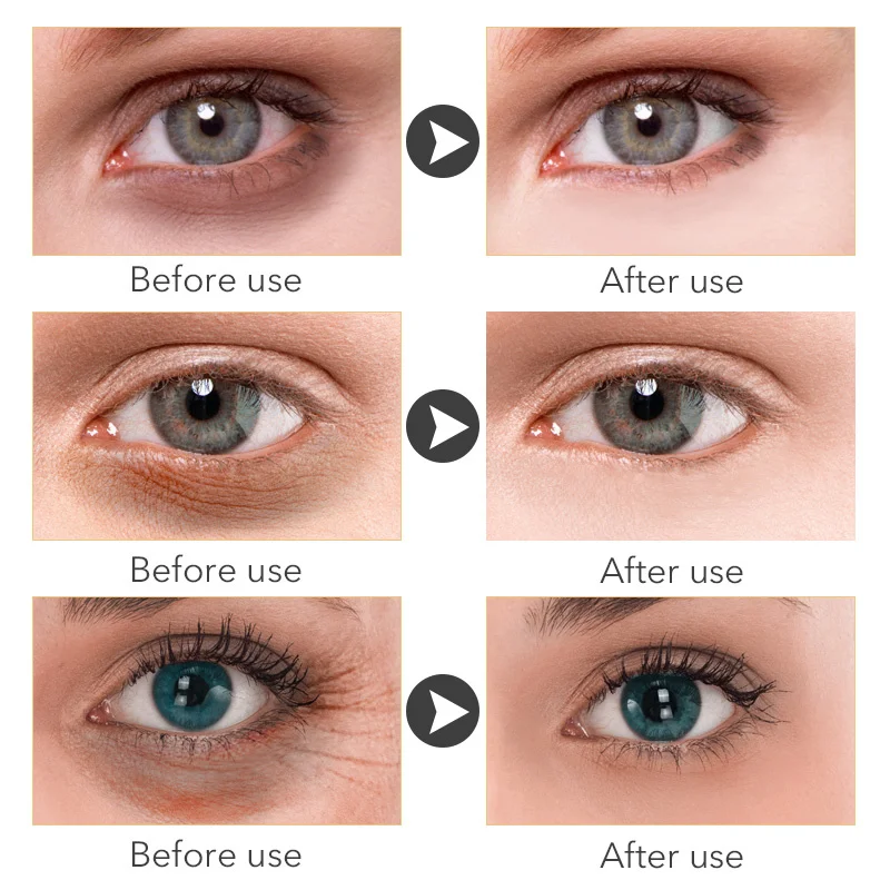Collageen Rimpels verwijderen Oogcrème Vervagen Fijne lijntjes Lifting Stevige stimulator Crèmes Anti-donkere kringen Oogzakken Mois_voghion.com