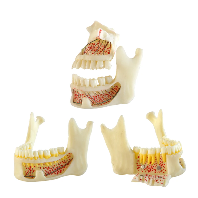 

Anatomic Mandible Model Mandible with Hinge Buccal Dentist Student Learning Tool Dental Materials