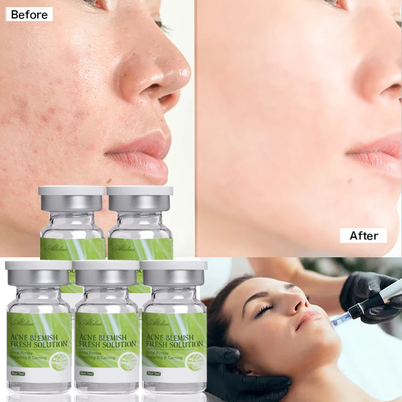 ZS Korean Skincare PDRN Salmon Dna Serum Collagen Peptide Face Lifting Egf Anti Aging Dark Spot Wrinkle Removal Ampoule