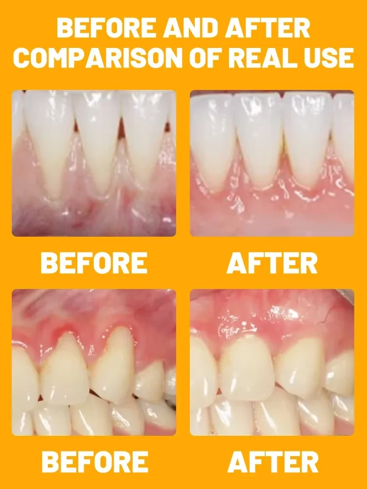 Rapid Repair Gums Serum Effectively Relieve Tooth Allergy Dental Caries Tooth Cleaning Toothpaste Relieve Damage Drops gum repair drops teeth health product