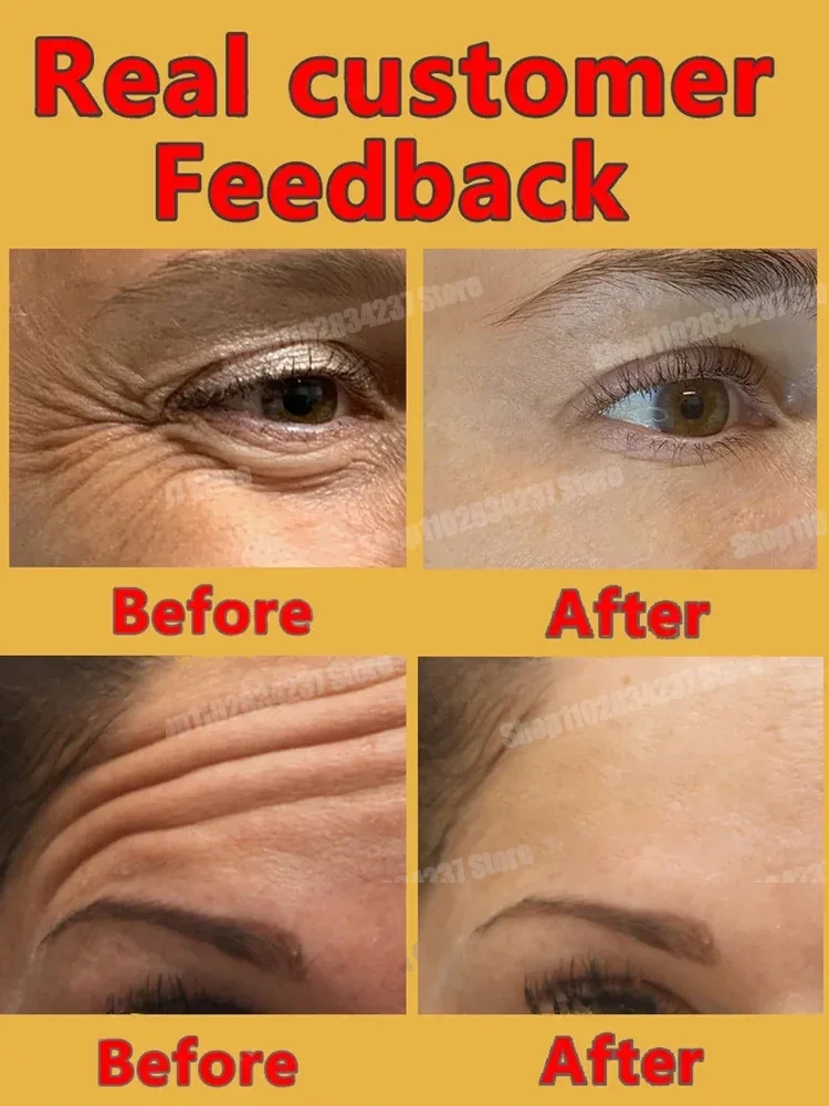 New Long-lasting anti-wrinkle facial serum calm moisturizing and moisturize to remove wrinkles around the eyes, fine lines
