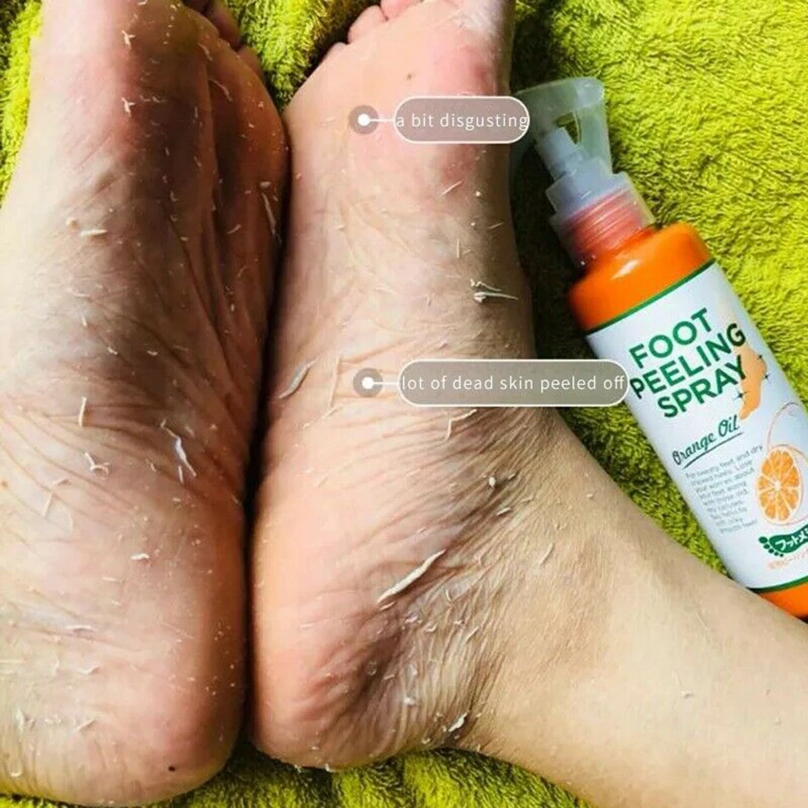 100ml Foot Peeling Spray Orange Essential Oil Exfoliating Nourish Peel Feet Calluses Dead Skin Remover Pedicure Foot Care Tool