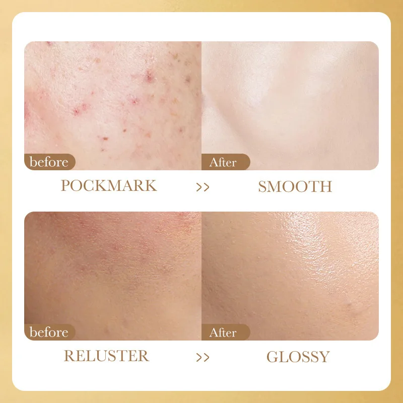 Niacinamide Whitening Face Serum  Freeze-Dried Podwer Set Shrink Pores Hydrating Brighten Anti-Aging Anti Wrinkle Skin Care 5