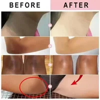 Crème blanchissante pour le corps peau foncée aisselles éclaircissante zones intimes aisselles blanchiment parties intimes crème blanchissante Lotion pour le corps beauté 2