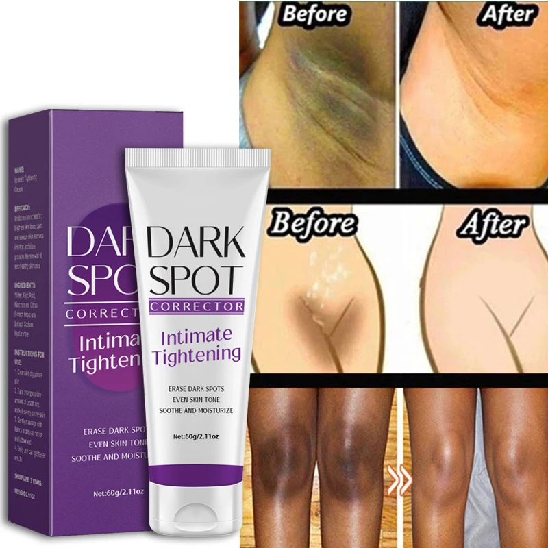 

Whitening Cream Remove Melanin Cream Quickly Private Parts Dark Skin Underarm Brightening Cream Inner Thighs Elbows Bleach Joint