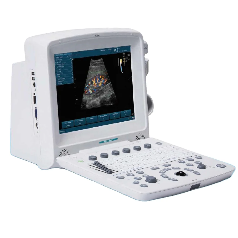 

EDAN U50 Scanner Machine ecografo ultrasonido Laptop Color Doppler portable ultrasound price