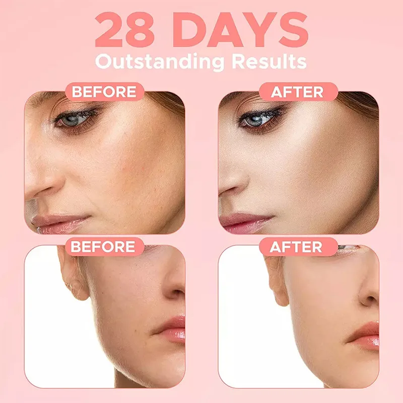 Ser facial antirid 4 în 1, albire, îndepărtează petele întunecate, micșorează porii, hidratant anti-îmbătrânire, hrănește îngrijirea pielii coreeană_voghion.com