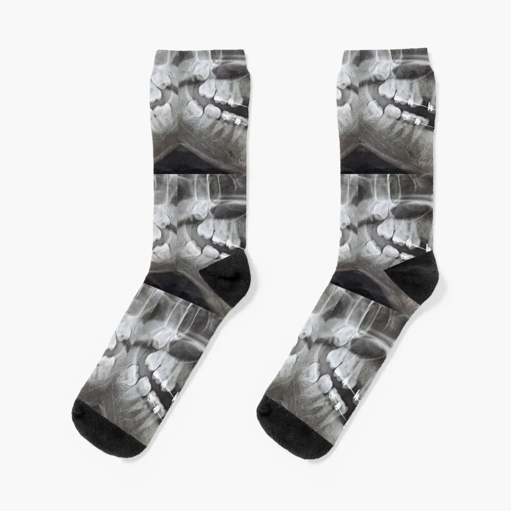 

panoramic-dental-x-ray Socks shoes sports and leisure designer brand Christmas Girl'S Socks Men's