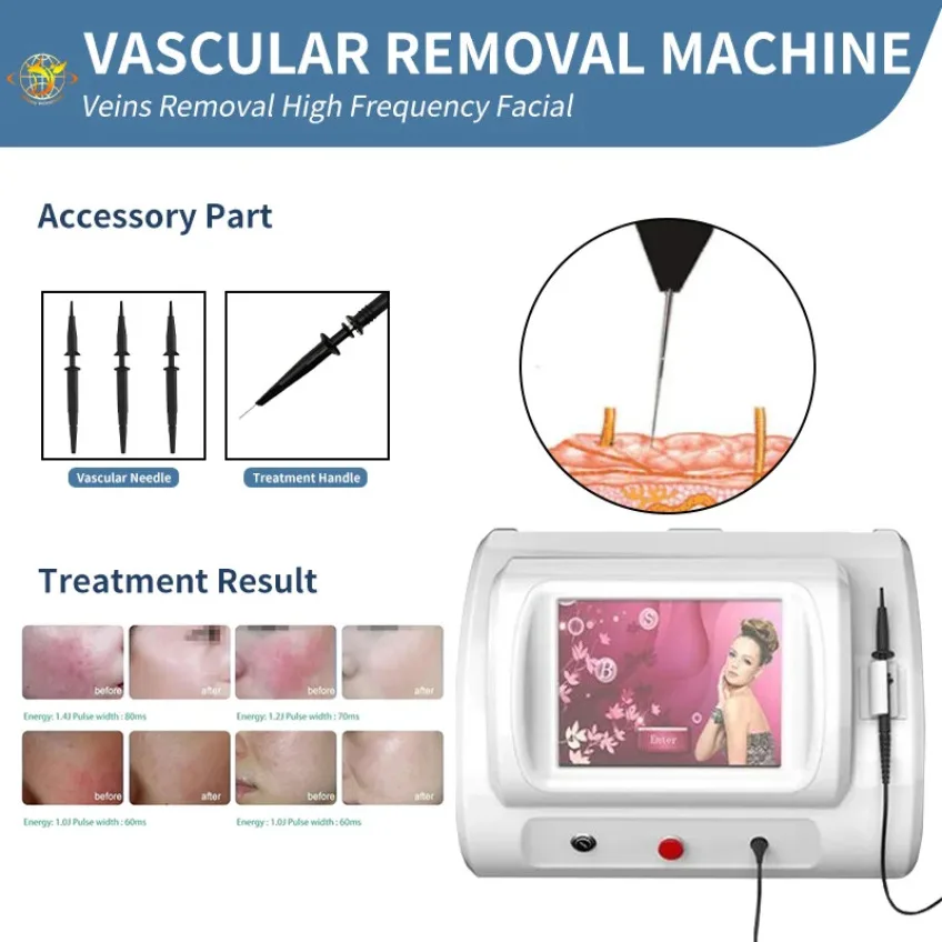

R-F Face Body Vascular Treatment Spider Vein Removal Machine Beauty Equipment