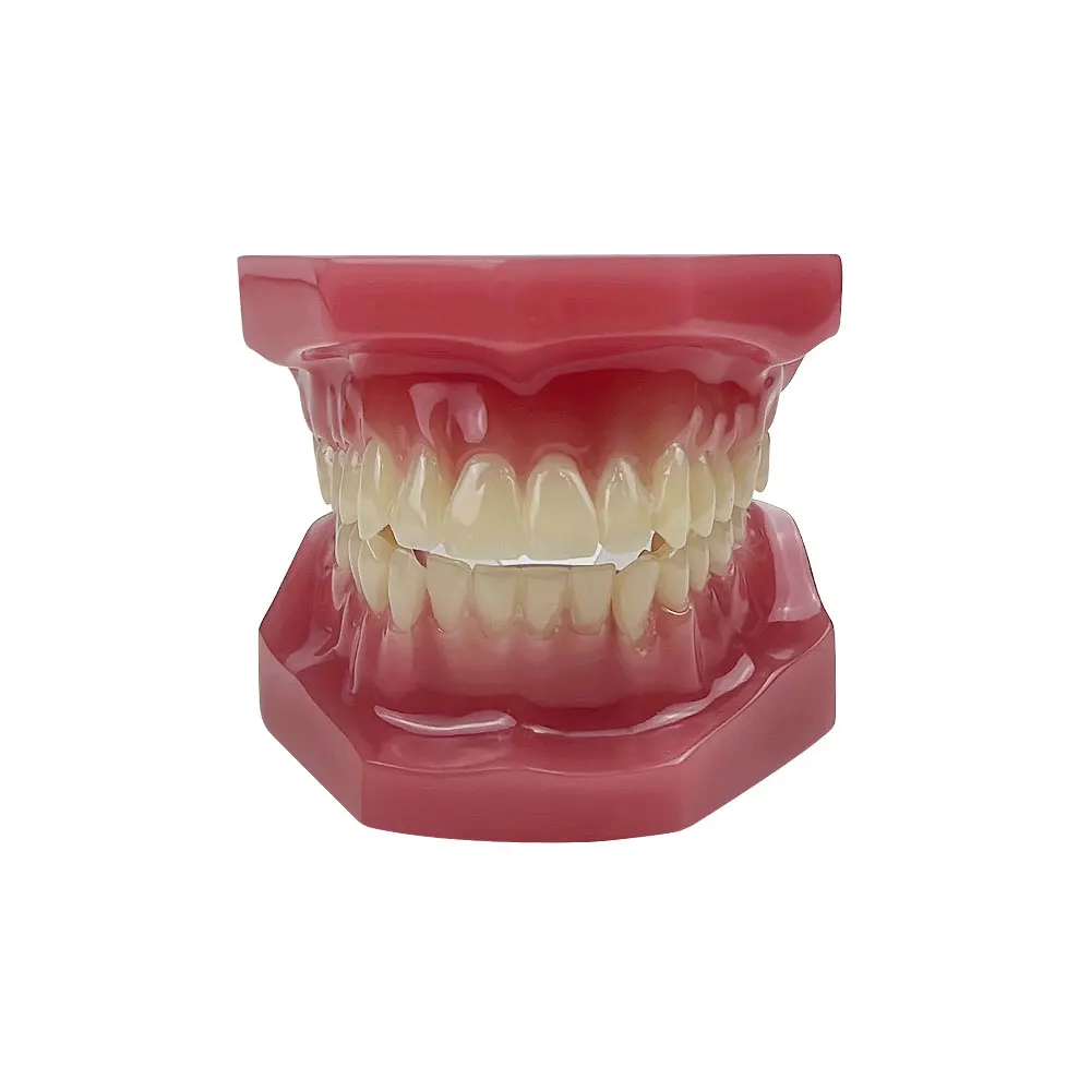 Orthodontic Teaching Model Oral Model Half Ceramic Half Metal Bracket for Dentist Doctor-patient Communication Tool