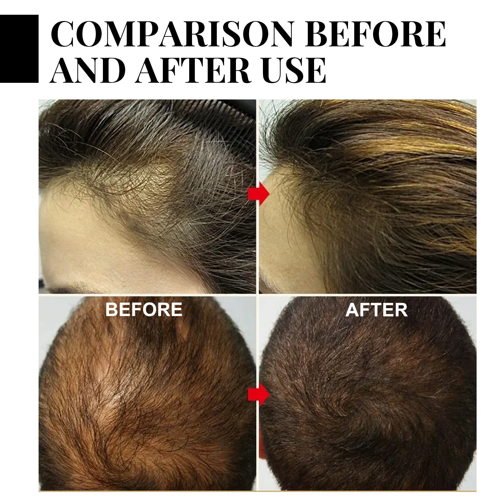 Anti Hair Loss Shampoo Repair Baldness Reduce Dandruff Itching Scalp Treatment Strengthen Thicken Nourishing Hair Growth Shampoo 5
