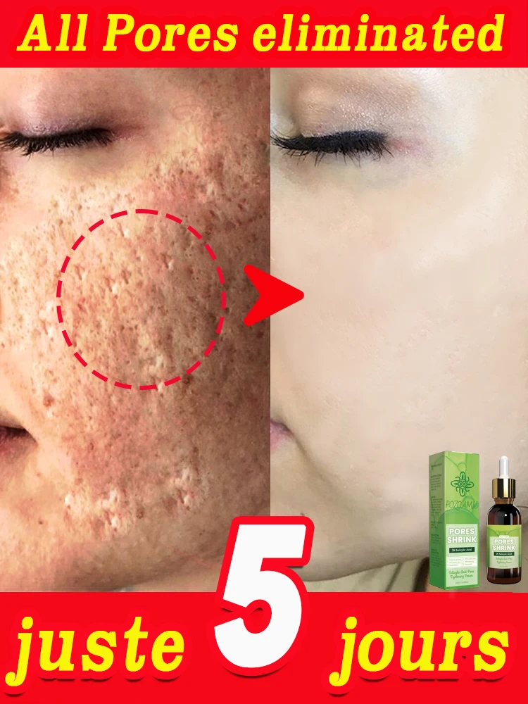 Facial Pore Tightening Essential Oil Witness The Miracle of Skin