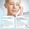 Acne Remover Soap Cleansing Anti Pimples Pores Whitening Oil-Control Brighten Moisturizing Fading Dark Spots Face Wash Skin Care 3