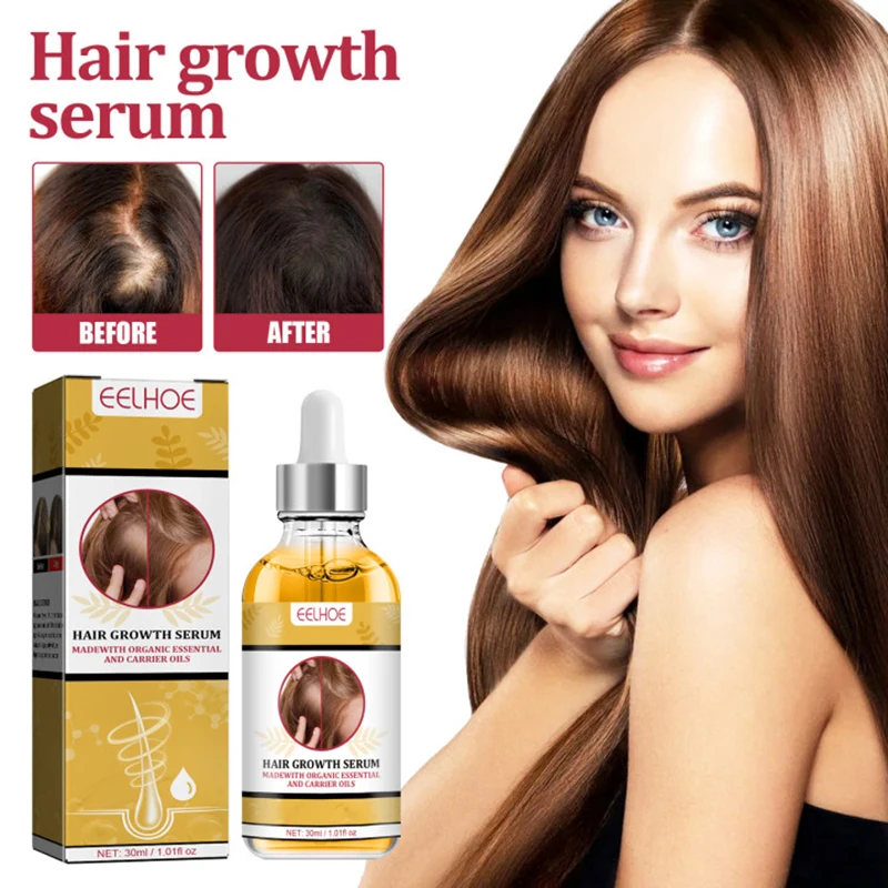 

2023 Biotin Fast Hair Growth Oil Hair Regrowth Serum Hair Thinning Treatment Hair Growth Liquid Anti-Hair Loss for Women and Men