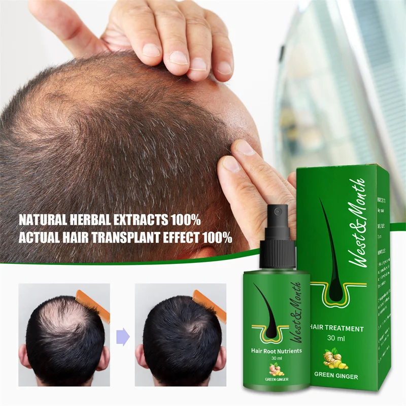 

2023 Hair Growth Oil Fast Hair Growth Products Scalp Treatments Prevent Hair Loss Thinning Beauty Hair Care for Men Women 30ml