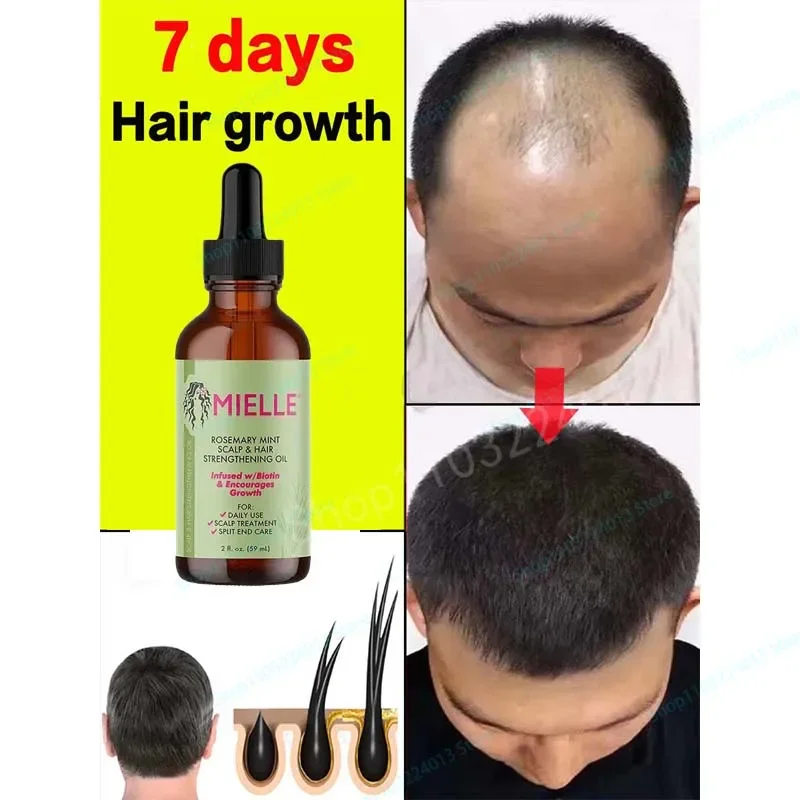 

Hair Growth Oil Fast Hair Growth Effective Baldness Repair Hereditary Hair Loss Postpartum Hair Loss Seborrheic Hair Loss
