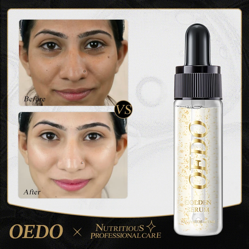 OEDO Gold Serum Anti-Aging Fade Fine Lines Deeply Nourishing Moisturizing hydrating Improve skin tone Facial Treatment Essence 5