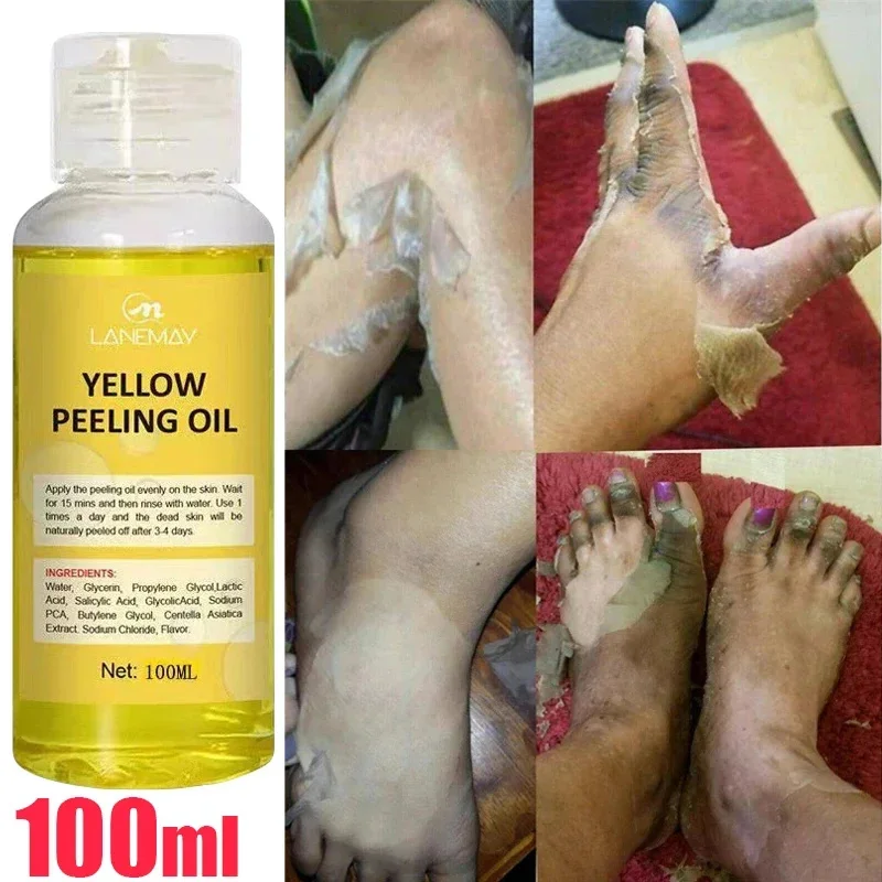 Body Care Exfoliating Yellow Peeling Oil 100% Organic Bleaching Dark Skin Serum Dark Knuckles Fast Whitening Korean Cosmetics