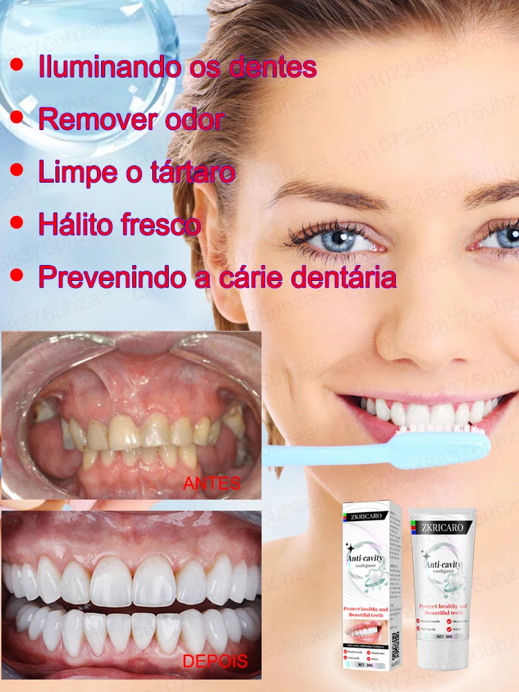 Anti Cavity Whitening Toothpaste to Clean Oral Cavity and Repair Tooth Enamel Dental Caries Decay Prevent for Children Adults