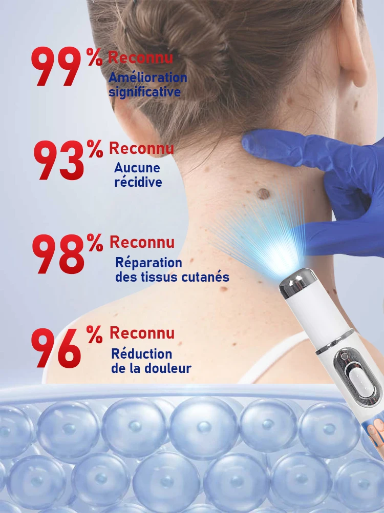 Outil Wart Blue Light, plus de réductions sur les ensembles