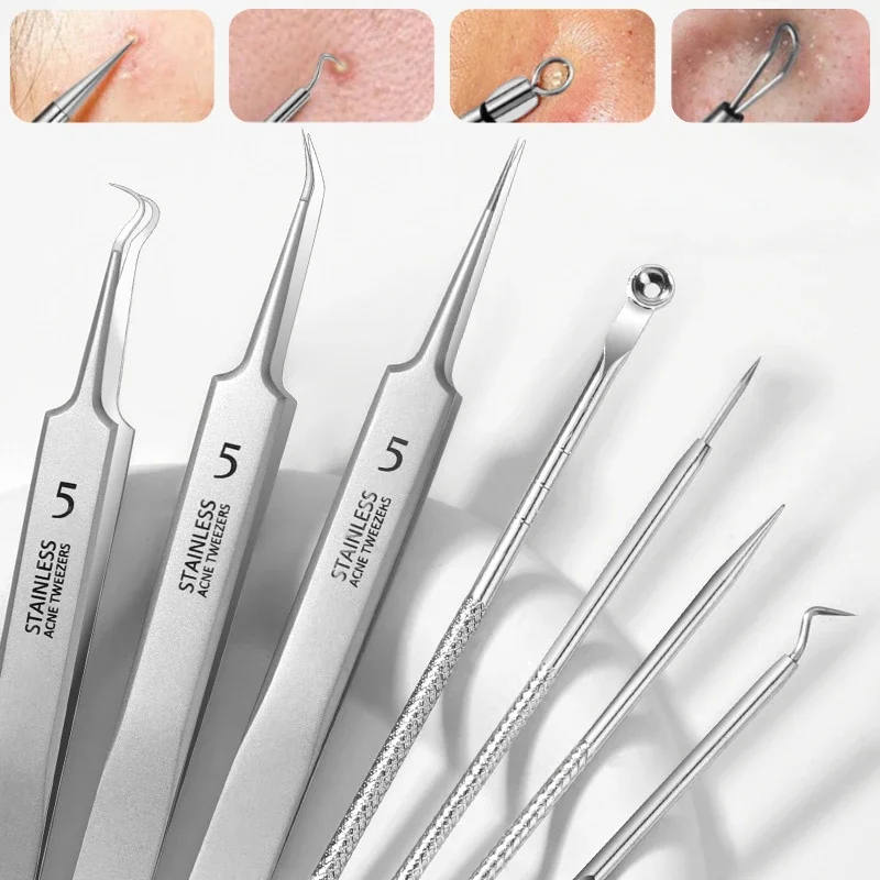 German No. 5 Cell Pimples Blackhead Clip Tweezers Beauty Face Health Salon Special Blackhead Remover Acne Needle Tool