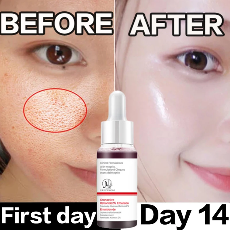 

Pore Minimizer Serum For Face Pore Facial Pore Narrowing Serum Pore Contraction Tightens Essence Shrink Pores Serum