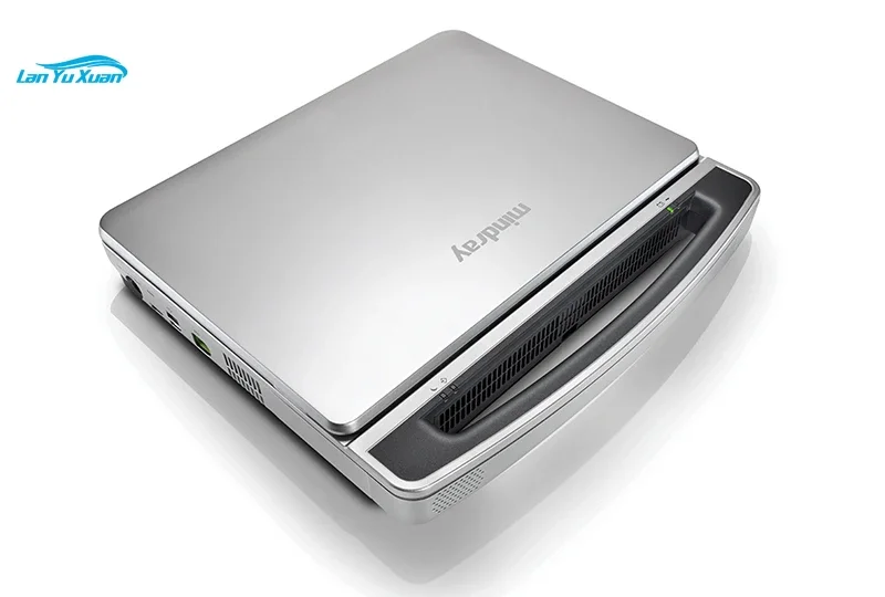 Рисунок 4 - Портативный ультразвуковой аппарат