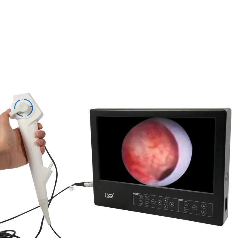 

Cheap Price Flexible Ureteroscope Ureteral Stones Single Use Ureteroscope