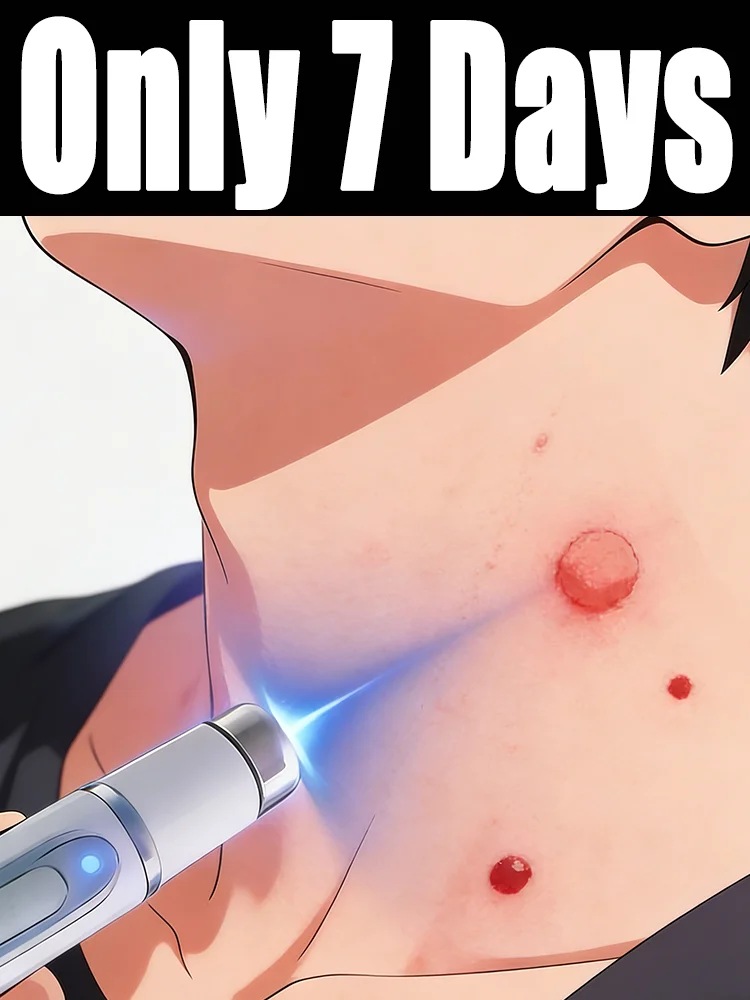 The first generation of improved  ᴡᴀʀᴛ ʀᴇᴘᴀɪʀ ᴀɢᴇɴᴛ ᴡᴀʀᴛ ʀᴏᴏᴛ ғᴀsᴛ